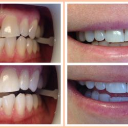 Beverly Hills Dental Center