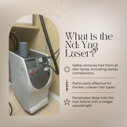 Laser Affair