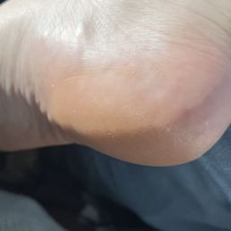 My feet less than 4 hours after my pedicure. My feet less than 4 hours after my pedicure.