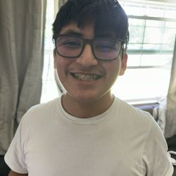 Chino Family Dental - First day of braces