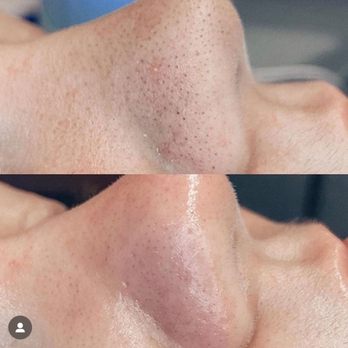 RNLosangeles - Skin Care Near Me - Studio City, California RNLosangeles - Skin Care Near Me - Studio City, California