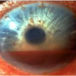 Roth Vision Care