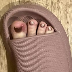 Diamond Nails & Spa - Toe infection