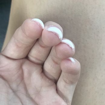 Nails 2000 - Gobs of acrylic under my nails, uneven thickness - Nail Salons Near Me - Louisville, Colorado Nails 2000 - Gobs of acrylic under my nails, uneven thickness - Nail Salons Near Me - Louisville, Colorado