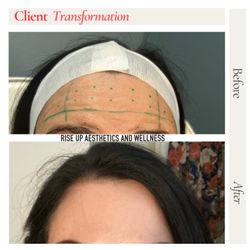 Rise Up Aesthetics and Wellness - We take the time to make sure you get results