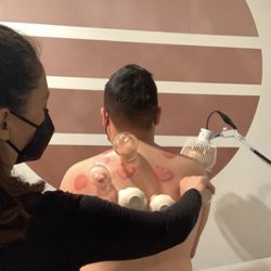 Shen+Tonic - Cupping; heart and circles shapes. A huge relief after session.