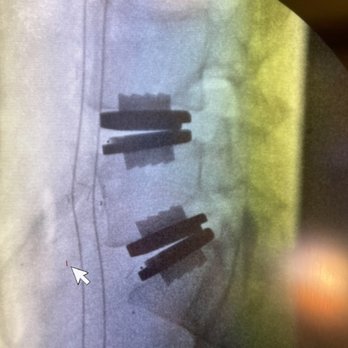 Lanman H Todd, MD - Lanman Spinal Neurosurgery - Spine Surgeons Near Me - Beverly Hills, California