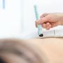 EcoAcupuncture