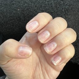 After soak off