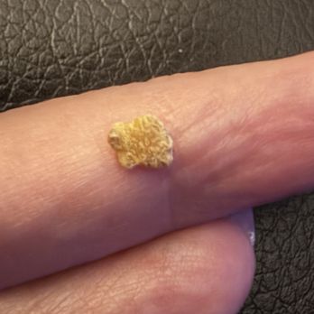 Mandolas Italian Kitchen - This was a rock in my Chopped Italian Salad - Italian Near Me - Oldsmar, Florida