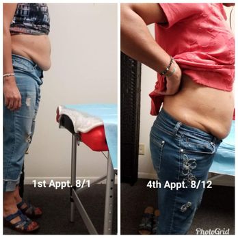 D’Luxe Silhouettes - Laser Lipo and Lipo Cavitation Combined - Medical Spas Near Me - Raytown, Missouri D’Luxe Silhouettes - Laser Lipo and Lipo Cavitation Combined - Medical Spas Near Me - Raytown, Missouri