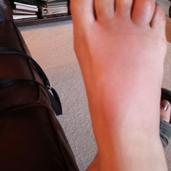 T Nails - Bacterial infection contracted at T's NAILS in Graham, Wa. - Nail Salons Near Me - Graham, Washington T Nails - Bacterial infection contracted at T's NAILS in Graham, Wa. - Nail Salons Near Me - Graham, Washington