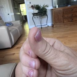 Lee Nail - Five days later still so short and not throbbing, but still sore when I try to use my fingertips