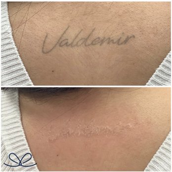 Jessica Bruns Beauty Studio - Laser tattoo removal - Permanent Makeup Near Me - Malden, Massachusetts Jessica Bruns Beauty Studio - Laser tattoo removal - Permanent Makeup Near Me - Malden, Massachusetts