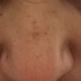 SINY Dermatology