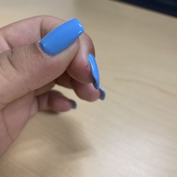 Spectrum Nail Spa - Cut from filing (looked heated a bit because covered with cream overnight) - Nail Salons Near Me - Elk Grove, California Spectrum Nail Spa - Cut from filing (looked heated a bit because covered with cream overnight) - Nail Salons Near Me - Elk Grove, California