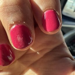 Small bumps and scratched up Small bumps and scratched up