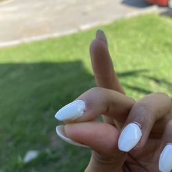 Nail glue along the sides of my fingers