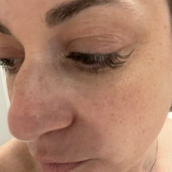 Deka Lash - Holes in lash pattern. - Eyelash Service Near Me - Chamblee, Georgia