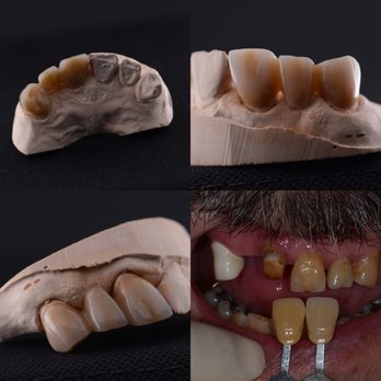 Astro Dental Art - Medical Supplies Near Me - Calgary, Alberta Astro Dental Art - Medical Supplies Near Me - Calgary, Alberta