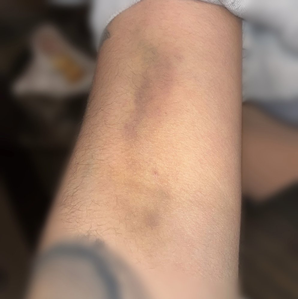 CSL PLASMA Updated September 2024 11 Photos & 36 Reviews 3298