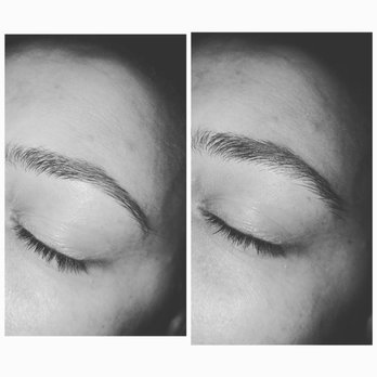 Skintuition - Skin Care Near Me - San Diego, California Skintuition - Skin Care Near Me - San Diego, California