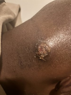 St Johns Episcopal Hospital