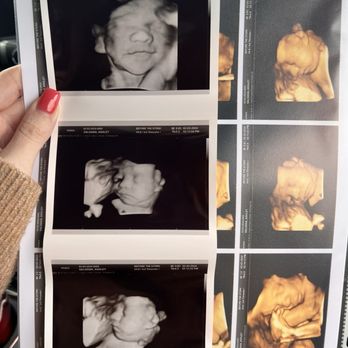 Before the Stork 4D - Ultrasound pictures! - Ultrasound Imaging Centers Near Me - Anaheim, California