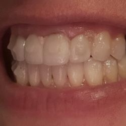 Holliday Dental