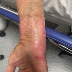 COMSI - Cast being too tight