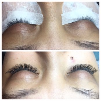 Skin Technics - Waxing Near Me - Tustin, California Skin Technics - Waxing Near Me - Tustin, California