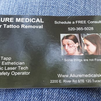 Allure Medical Spa - Business card. - Tattoo Removal Near Me - Tucson, Arizona Allure Medical Spa - Business card. - Tattoo Removal Near Me - Tucson, Arizona