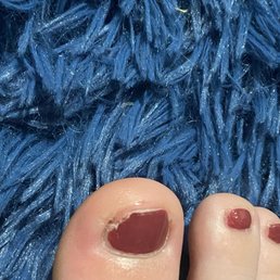 Toe infection Toe infection