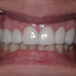 Nahel Yanni, D.D.S. Family & Cosmetic Dentistry - After