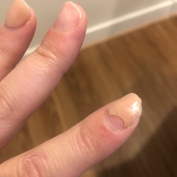 Starlight Nails - Chipped, cracked - Nail Salons Near Me - Arlington, Virginia