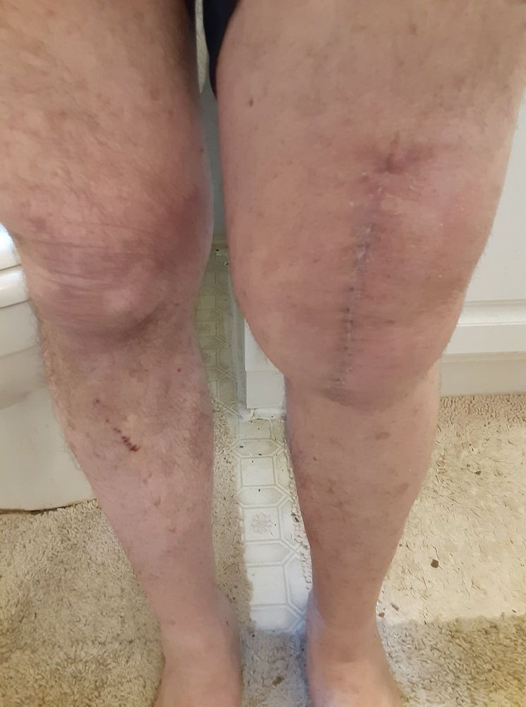 Orthocarolina - patient advocate in Charlotte, NC