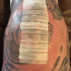 Scott And White Roney Bone And Joint Institute - After staples removed they put steri strips on for a week. They will fall off when ready but can remove in about a week.
