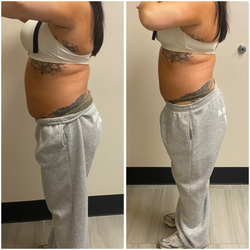 REFINE Non-Invasive Aesthetic & Wellness Center - Non-Invasive Laser Lipo