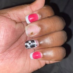 L A Nails - Fungus