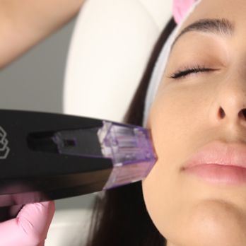 The Body Bar - Morpheus full face $400 if pre-purchased. - Medical Spas Near Me - Corona, California The Body Bar - Morpheus full face $400 if pre-purchased. - Medical Spas Near Me - Corona, California