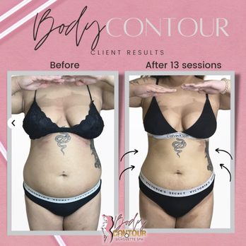 The Body Contour Spa - Body Contouring Near Me - Vancouver, British Columbia The Body Contour Spa - Body Contouring Near Me - Vancouver, British Columbia