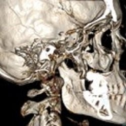 Neuvo Wellness - 3D imaging available