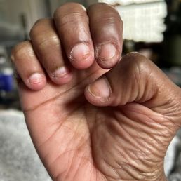 My nails and cuticles were shaved so deeply for gels that they bled. My right index finger became infected and needed antibiotics. Painful!
