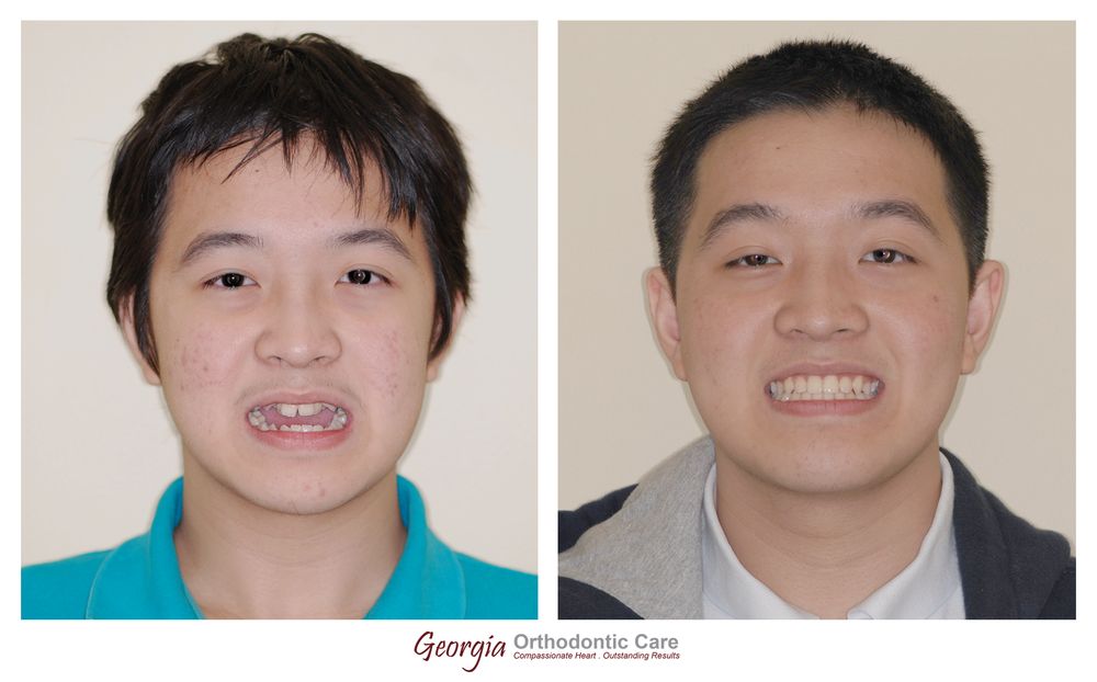 Georgia Orthodontic Care
