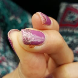 One week later.... infected and taking long to heal!