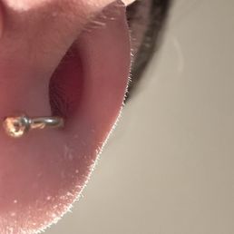 Seam ring installation from Ten Tigers. This was after the piercer attempted insertion at least 4 separate times and swore at the jewelry. Seam ring installation from Ten Tigers. This was after the piercer attempted insertion at least 4 separate times and swore at the jewelry.
