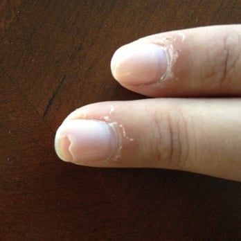 V Nails - My cuticle bled when the lady ripped the skin off!!!! - Nail Salons Near Me - Omaha, Nebraska V Nails - My cuticle bled when the lady ripped the skin off!!!! - Nail Salons Near Me - Omaha, Nebraska