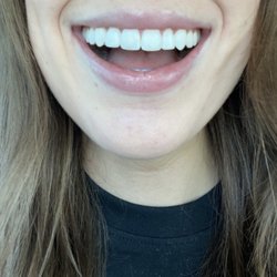Ossman Harding Dental - After