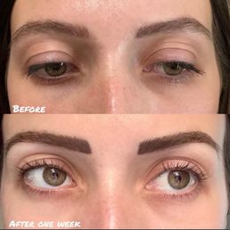 Before and After permanent cosmetics with Suzette Bennett. Still healing at one week (faded slightly to the perfect color). Before and After permanent cosmetics with Suzette Bennett. Still healing at one week (faded slightly to the perfect color).