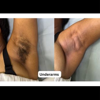 YourEstiNala - Underarm Wax - Skin Care Near Me - Snohomish, Washington YourEstiNala - Underarm Wax - Skin Care Near Me - Snohomish, Washington